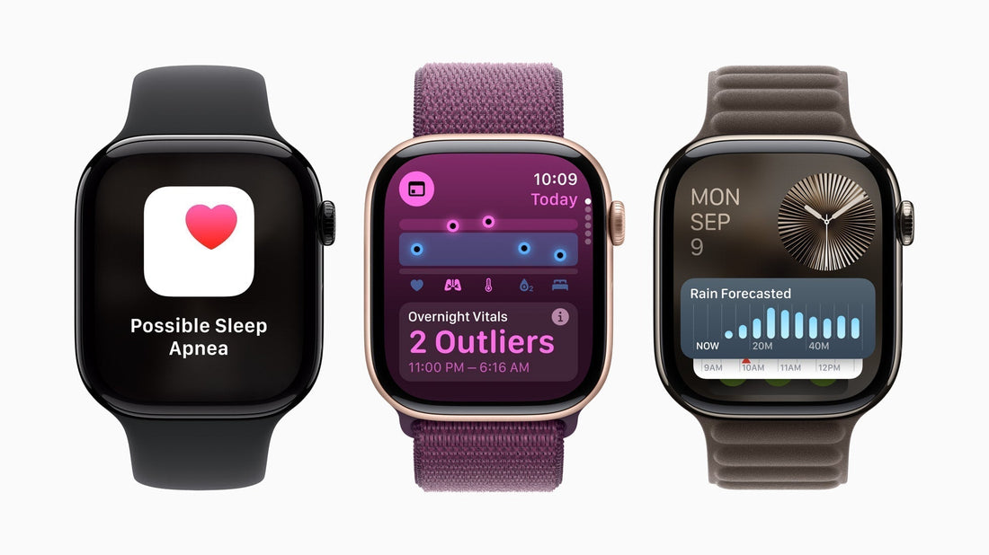 ¿Cuáles fueron las novedades de WatchOS 11?